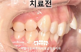 수술전