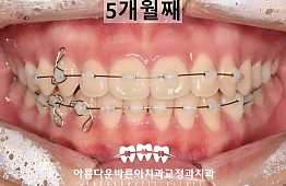 수술후