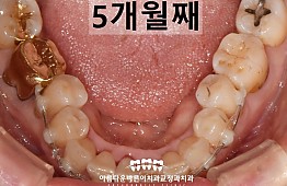 수술후