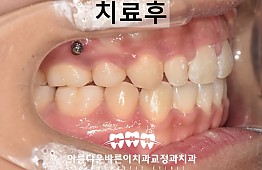 수술후