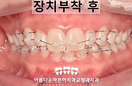 수술후