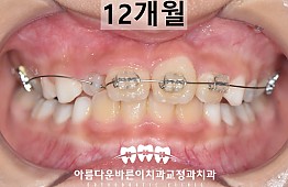 수술후