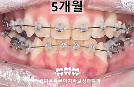 수술후