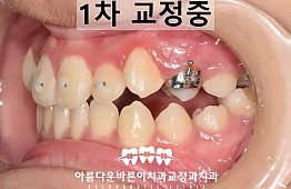 수술후