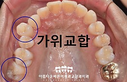 수술전