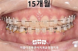 수술후