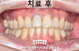 수술후