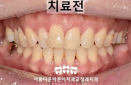 수술전