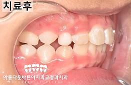 수술후