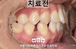 수술전