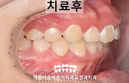 수술후