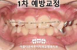 수술후