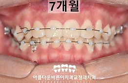 수술후