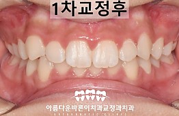 수술후