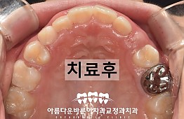 수술후