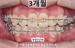 수술후