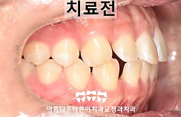 수술전