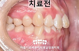 수술전