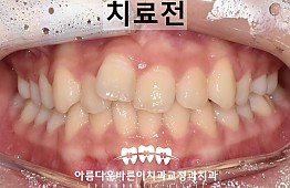 수술전