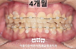 수술후