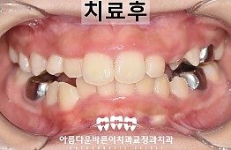 수술후