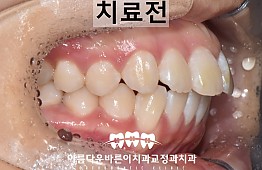 수술전