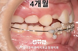 수술후