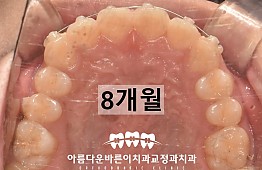 수술후