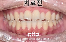 수술전