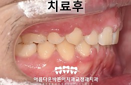 수술후