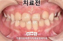 수술전