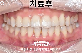 수술후