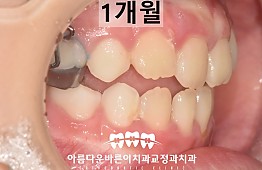 수술후