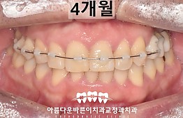 수술후