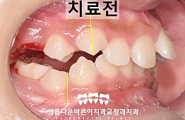 수술전