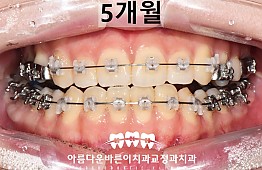 수술후