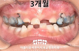 수술후