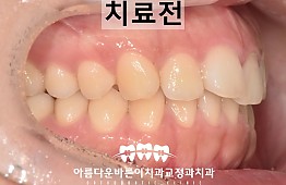 수술전