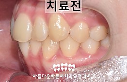 수술전