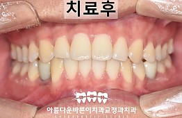 수술후