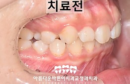 수술전