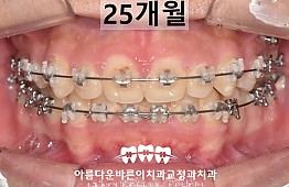 수술후