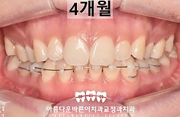 수술후