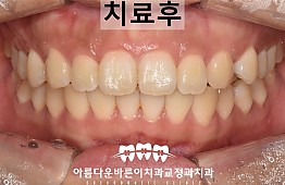 수술후