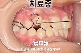 수술후