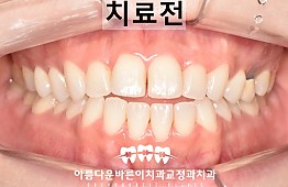 수술전