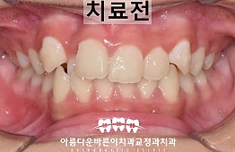 수술전