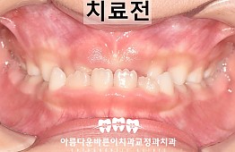 수술전