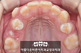 수술전