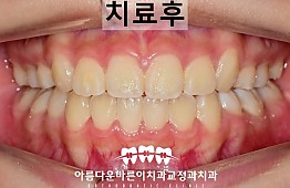 수술후